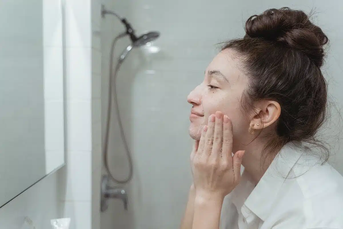 acné naturelle