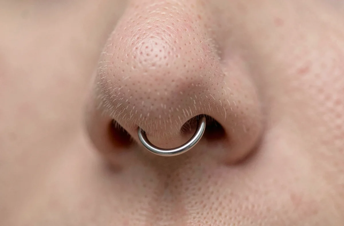 Gros plan macro d'un piercing nez en titane montrant des signes de rejet et migration cutanée autour du bijou